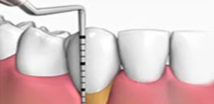periodoncia