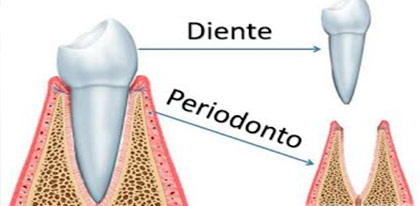 periodoncia2