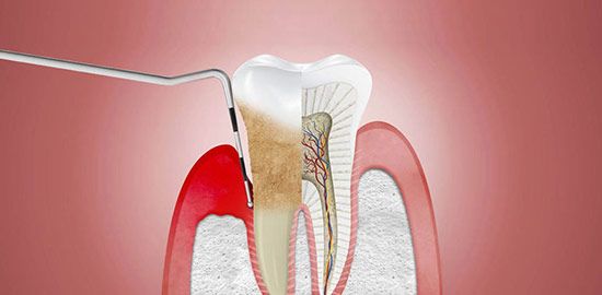 periodoncia