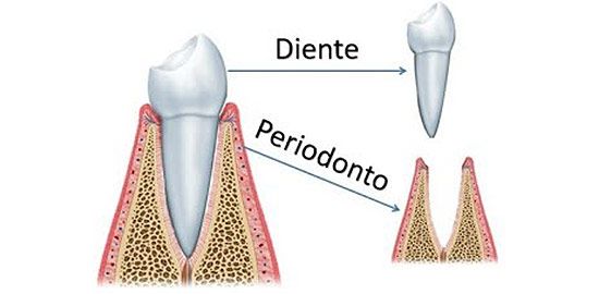 periodoncia2